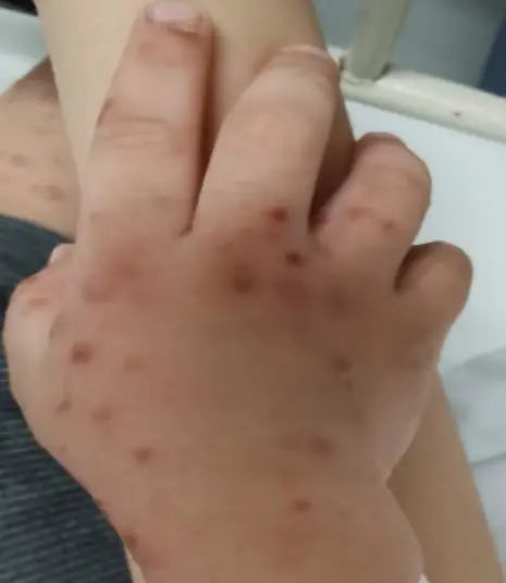 Many people have been infected in Xi 'an! Be alert, it's high recently!